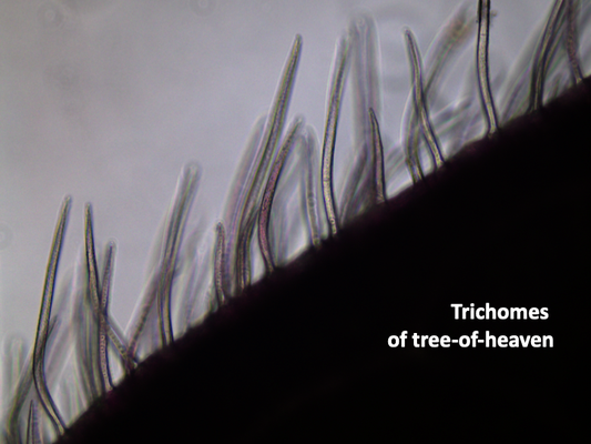 Theory of Surface-Area Dominance: A Natural Selection Paradigm Rooted in Rhizophagy and Endoglandular Cycling